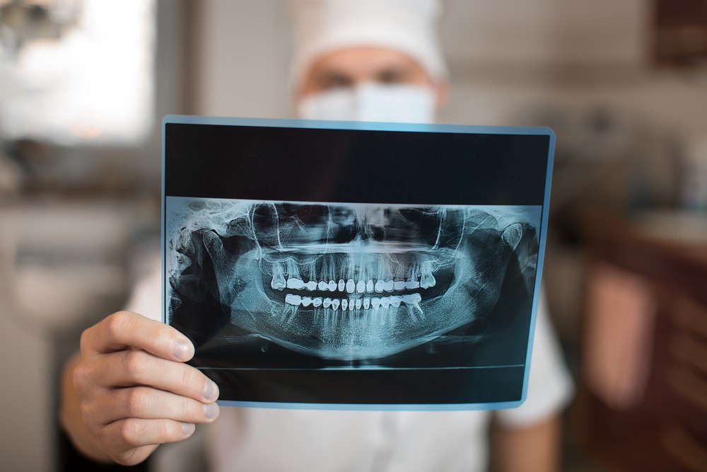 radiologie dentara baia mare, radiografie dentara baia mare, radiologie dentara baia mare pret